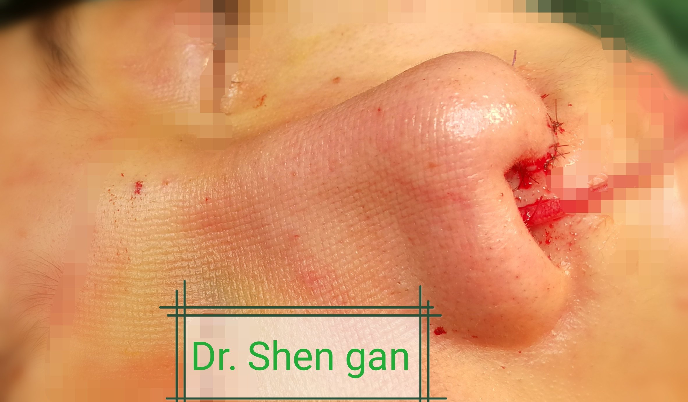 暂无