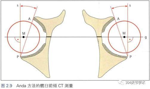 tha前傾角幾種測量方法