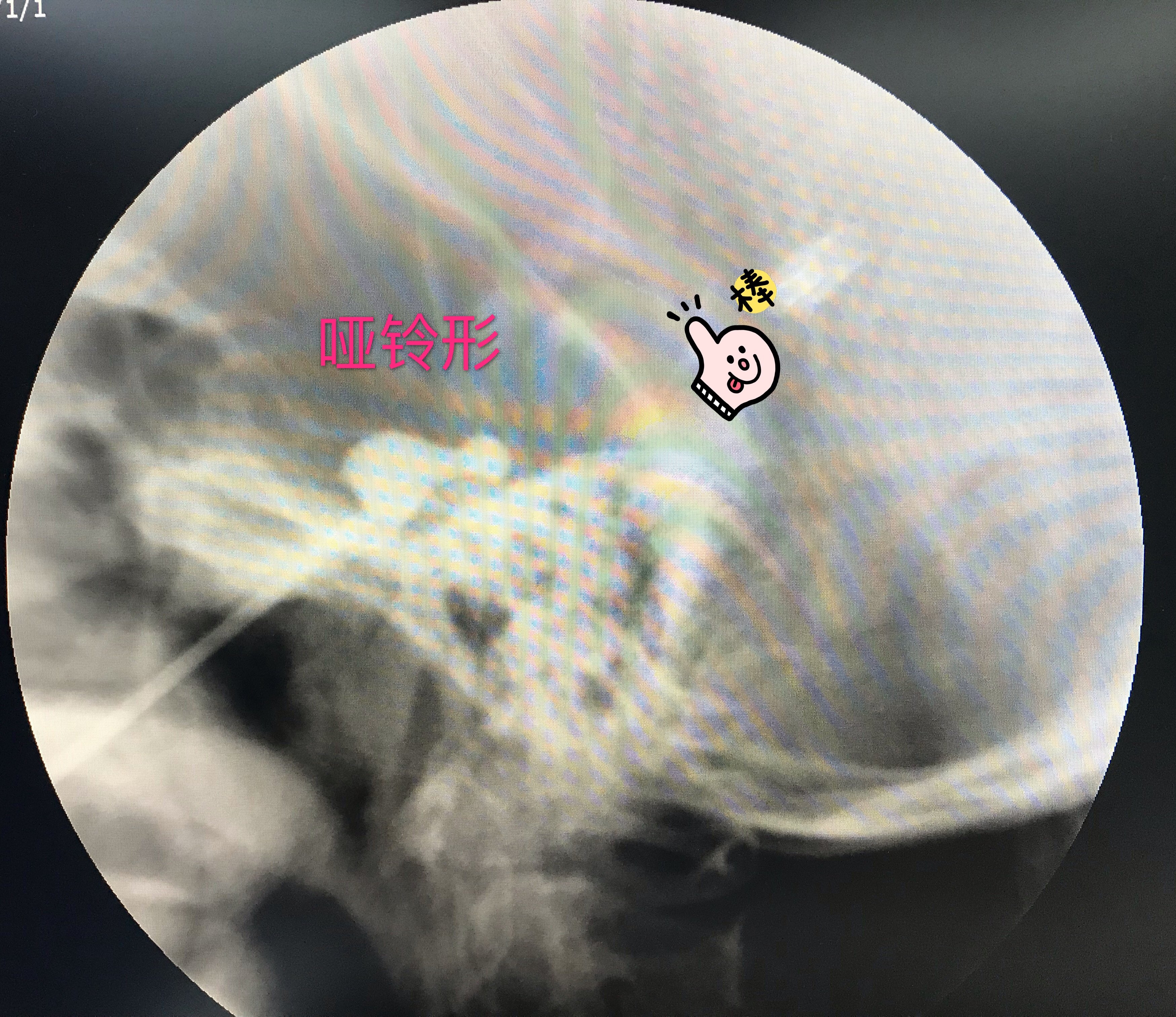 暂无
