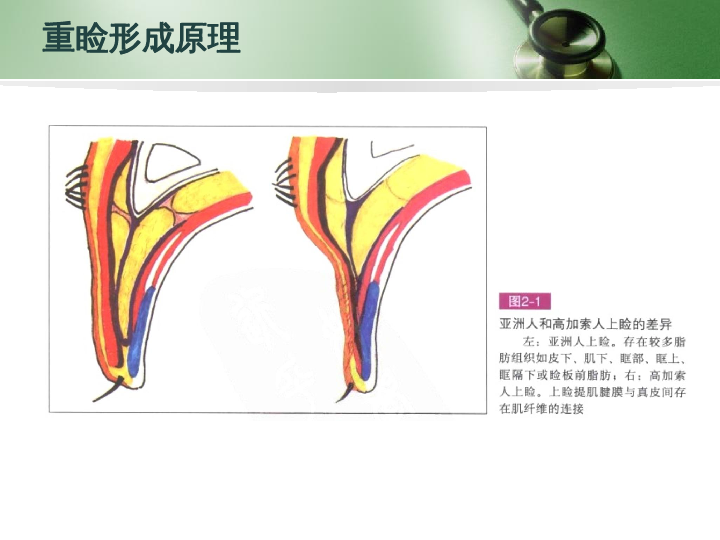 雙眼皮手術解剖基礎之原理篇