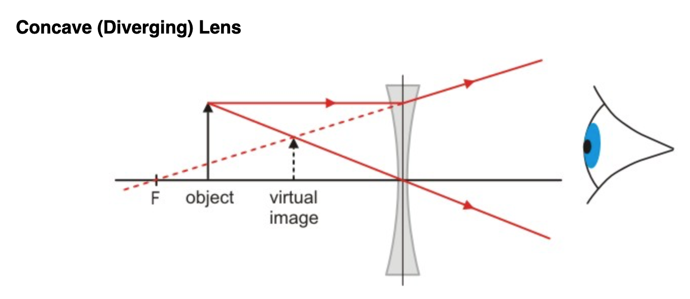 一般来说,矫正近视用凹透镜(concave lens,远视用凸透镜(convex lens
