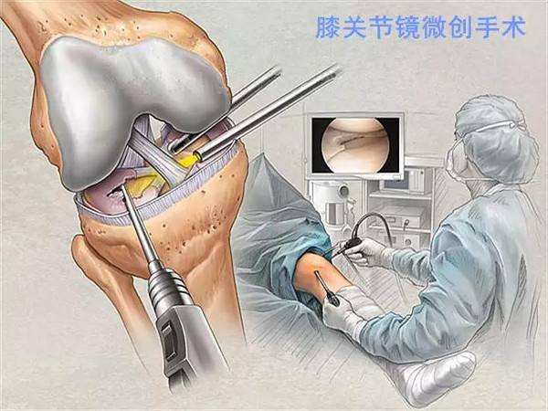 膝关节损伤_治疗方法_康复 - 好大夫在线