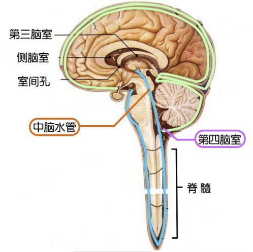 如在脑脊液循环图景中发生阻塞,比如中脑水管狭窄,蛛网膜囊肿等,使