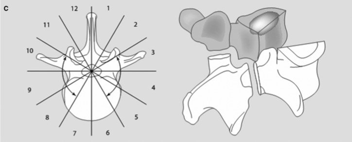 C-矢状切除（扇形切除）.jpg