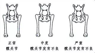 不容忽视的小儿健康筛查项目——小儿髋关节发育不良(ddh)_症状_检查