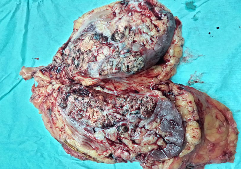 關于二龍路肛腸醫院黃牛排隊掛號CT加急說到必須做到的信息 關于二龍路肛腸醫院黃牛排隊掛號CT加急說到必須做到的信息