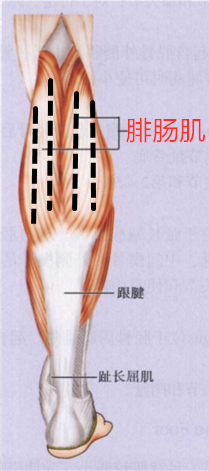 肉毒素瘦小腿须知_注射美容_治疗介绍_禁忌 - 好大夫在线