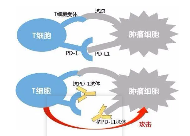 【深度】宫颈癌靶向治疗的时代来临了吗?