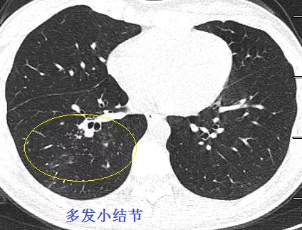 圖文圖片