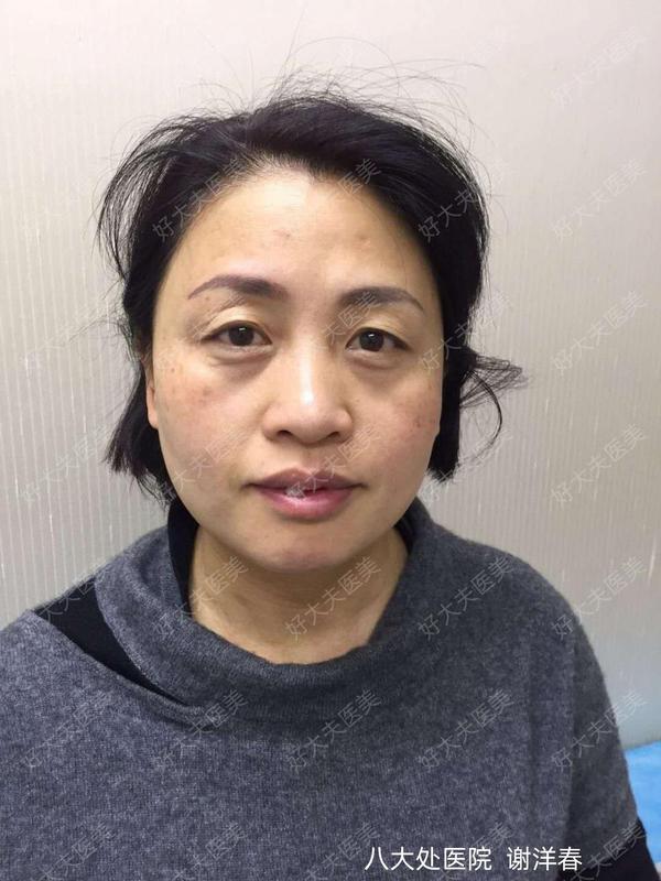 圖文圖片