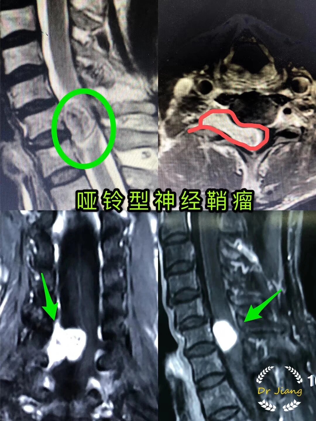 暂无