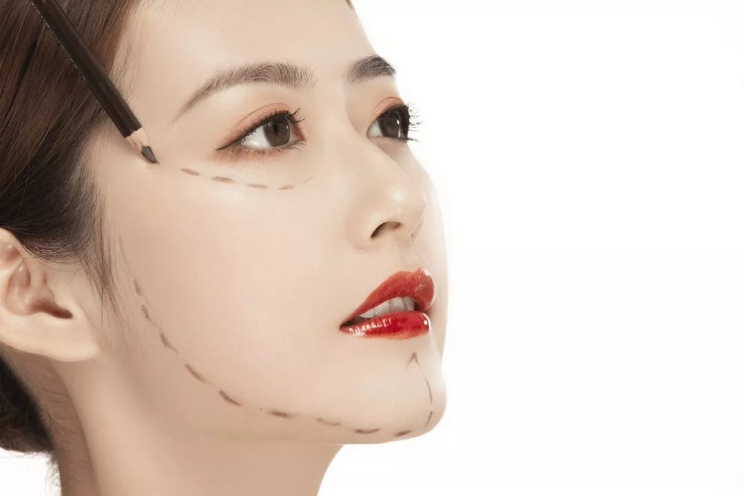 线雕干货:"大v线"和"小v线"有什么区别?