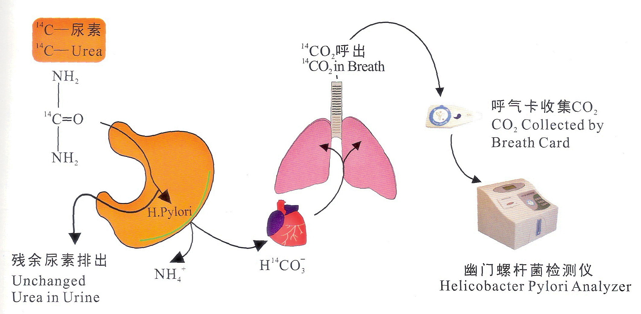 检测幽门螺杆菌(hp)——14碳尿素呼气试验(14c-ubt)的安全性问题 - 好