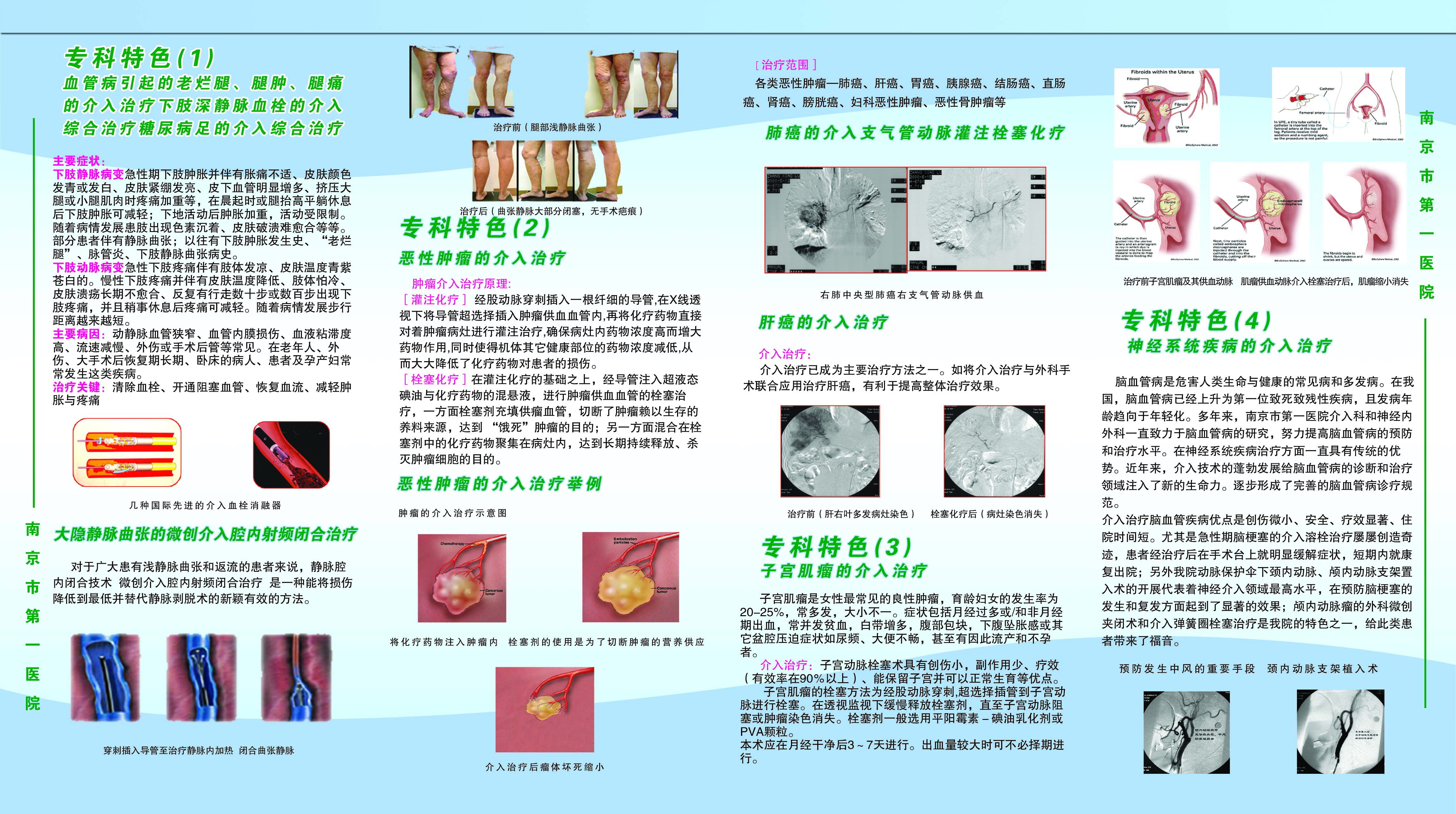 介入手术宣教图片图片