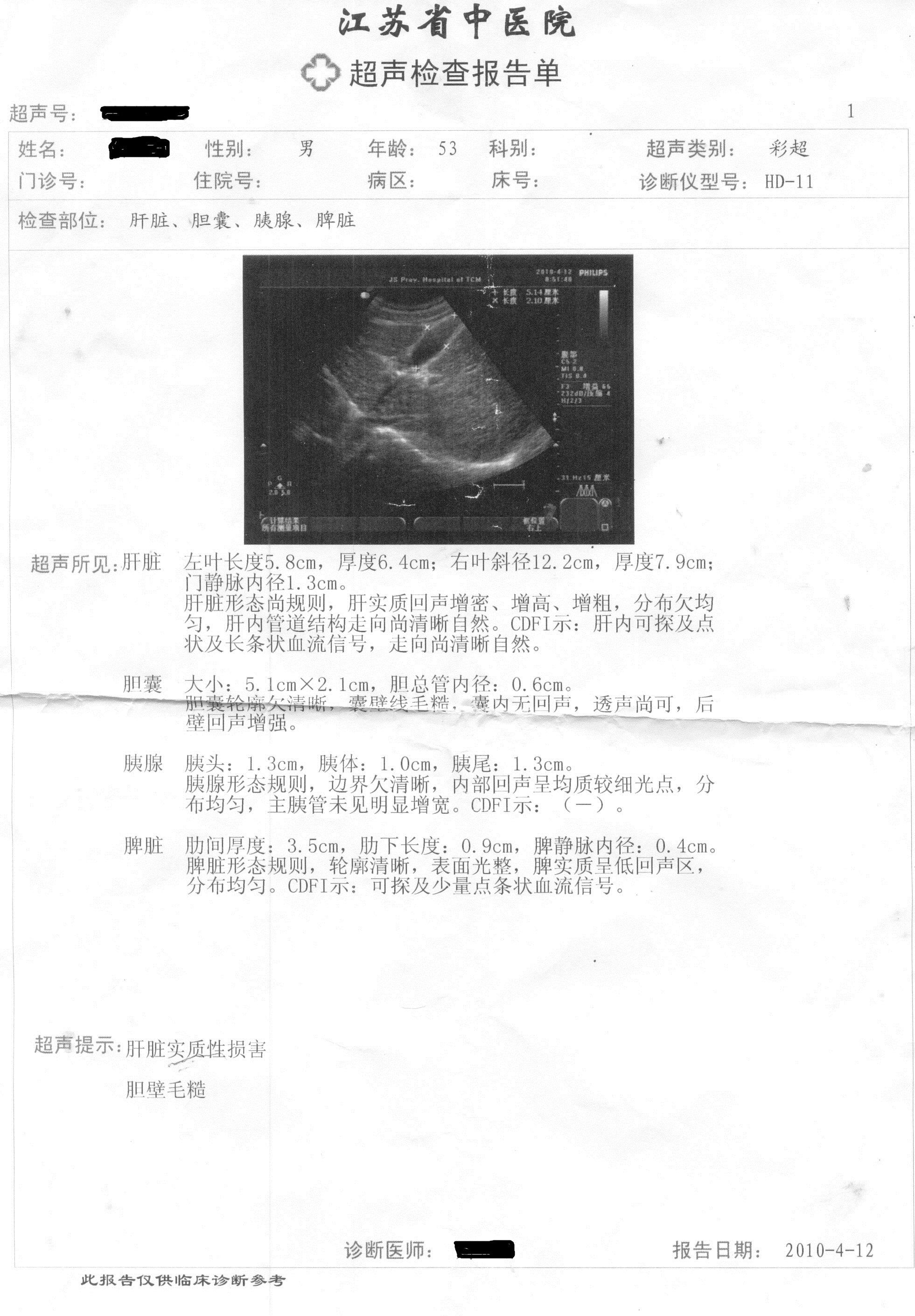 肝硬化病人中医治疗病例