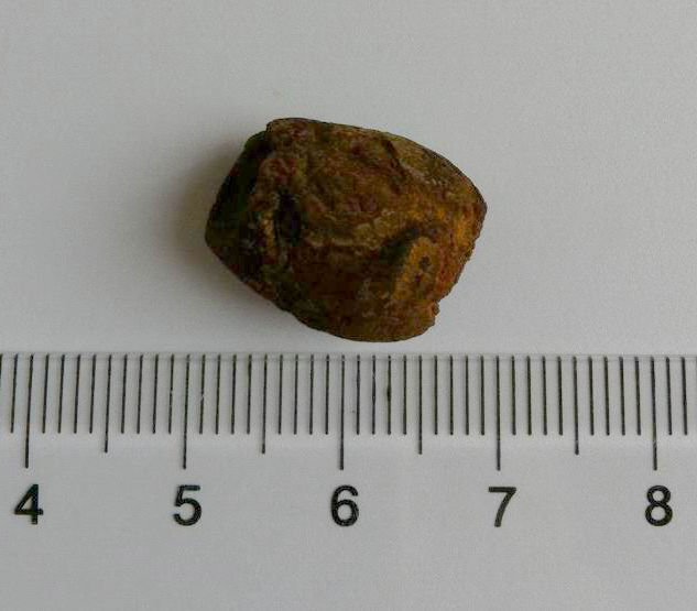 ercp技术是治疗胆总管结石及梗阻性黄疸的先进微创方法