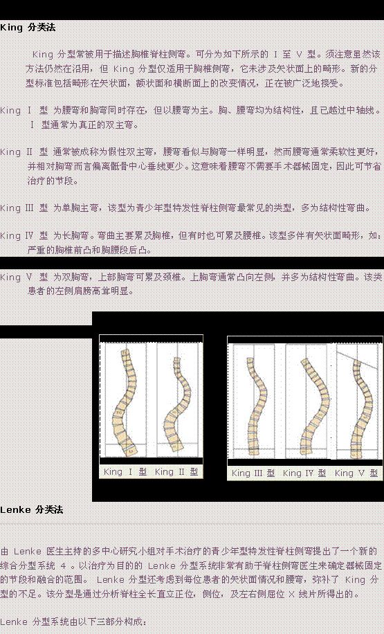 脊柱侧弯的分型系统