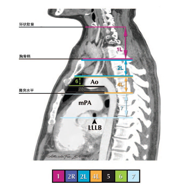 縱隔淋巴結分區圖譜美國胸科協會