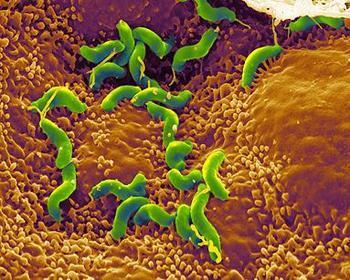 哪些人需要根除幽门螺杆菌——附幽门螺杆菌电子显微镜图片 