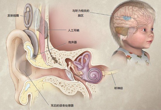 耳蜗的准确位置图图片