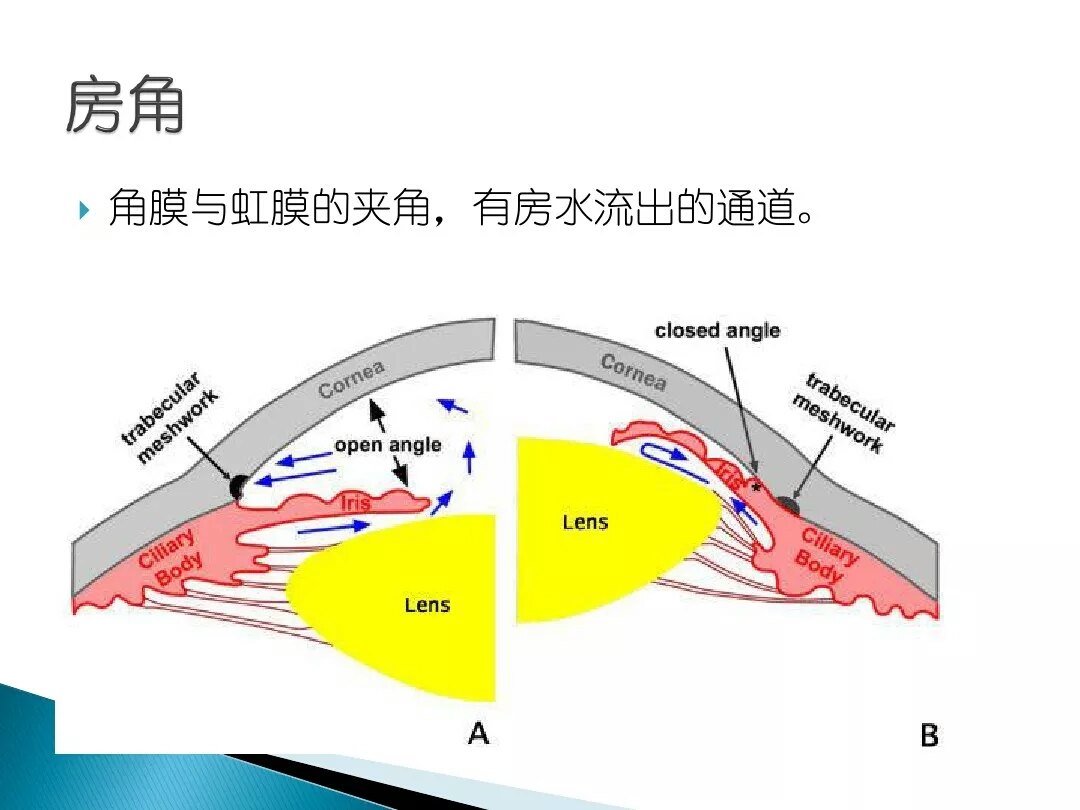 房角镜及三面镜检查