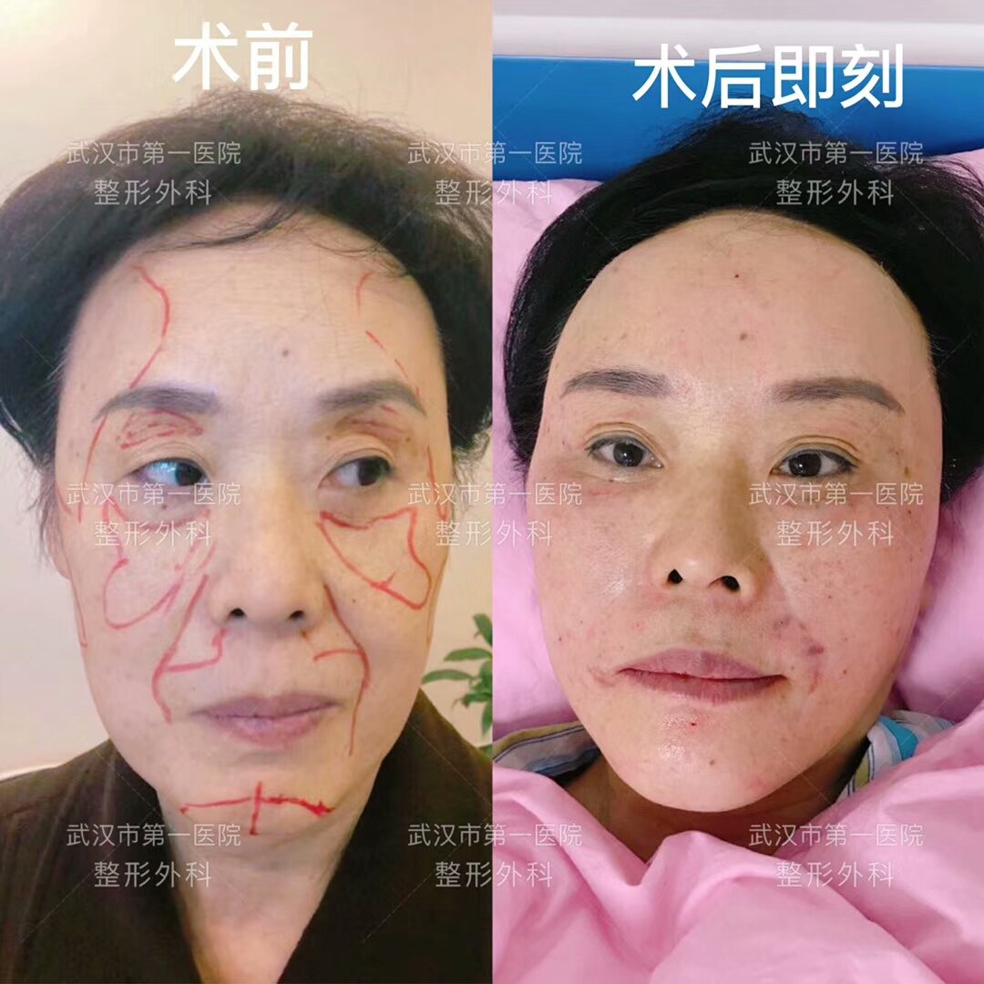 暂无
