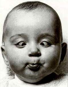 家长发现斗鸡眼怎么办?