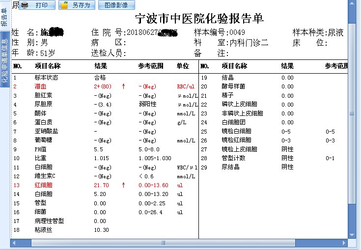 2018年7年4日複查尿常規,潛血(2 )尿蛋白(-),紅細胞21.