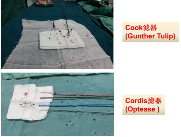 1531723308682207.png 可回收滤器及其装置.png