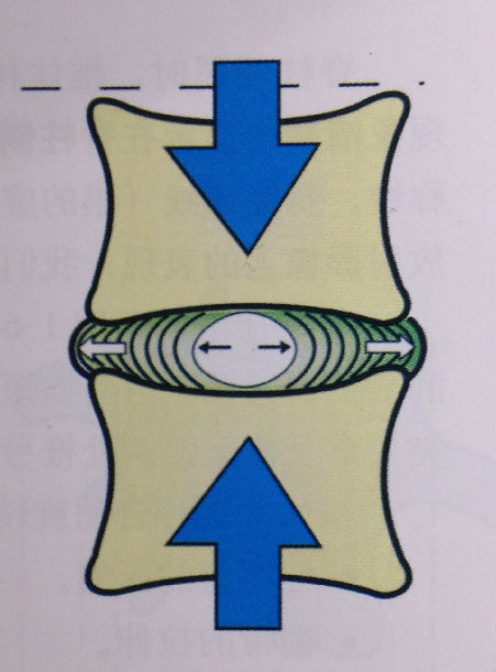 當脊柱在軸向上主動伸長時,終板平面出現分離,由此增加椎間盤的厚度.
