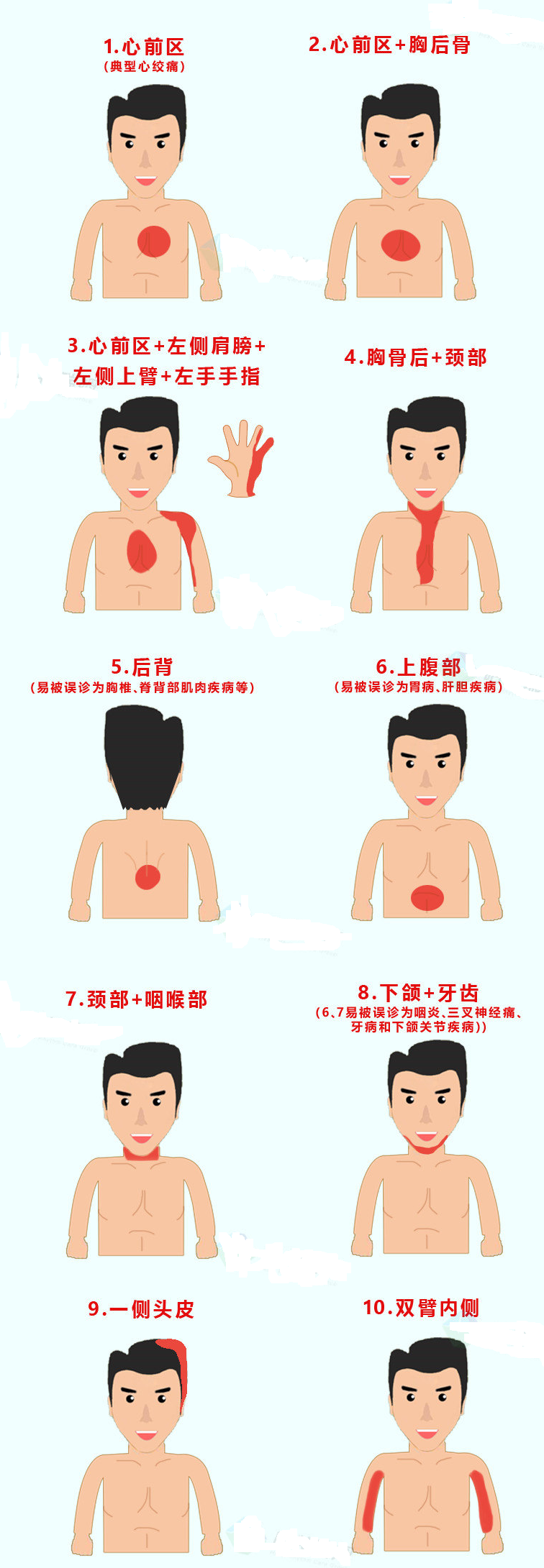 10个常见心梗疼痛示意图心绞痛发作时