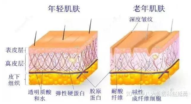 面部微创五层提升是对皮肤深层次提升,所以说无论哪个年龄段,理论上都