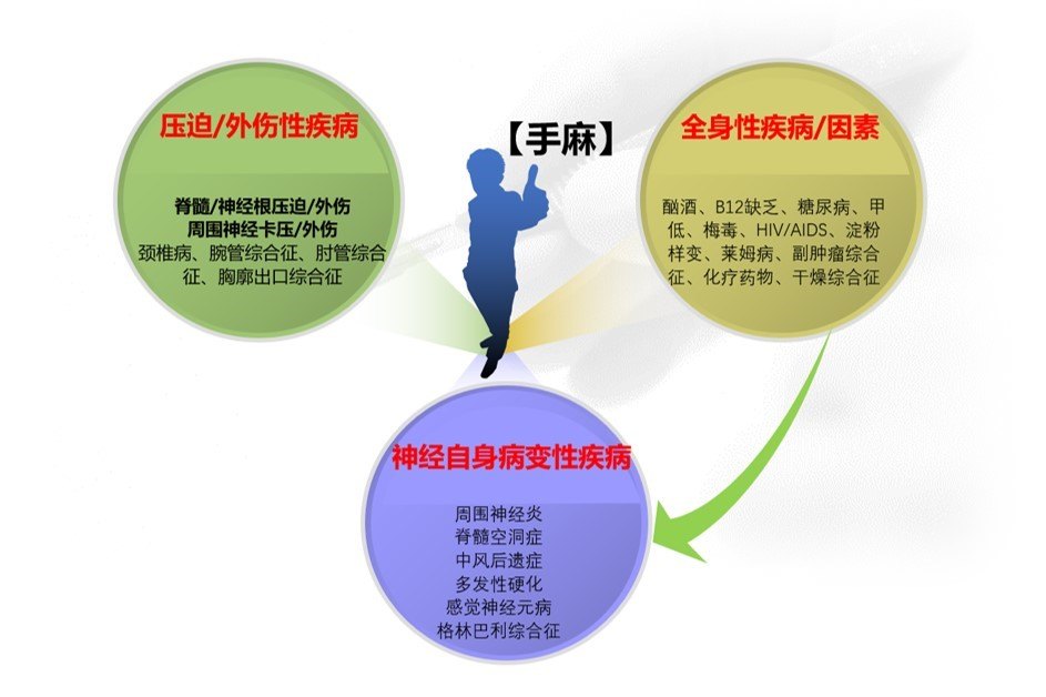 【手麻】--究竟到哪个科室就诊?