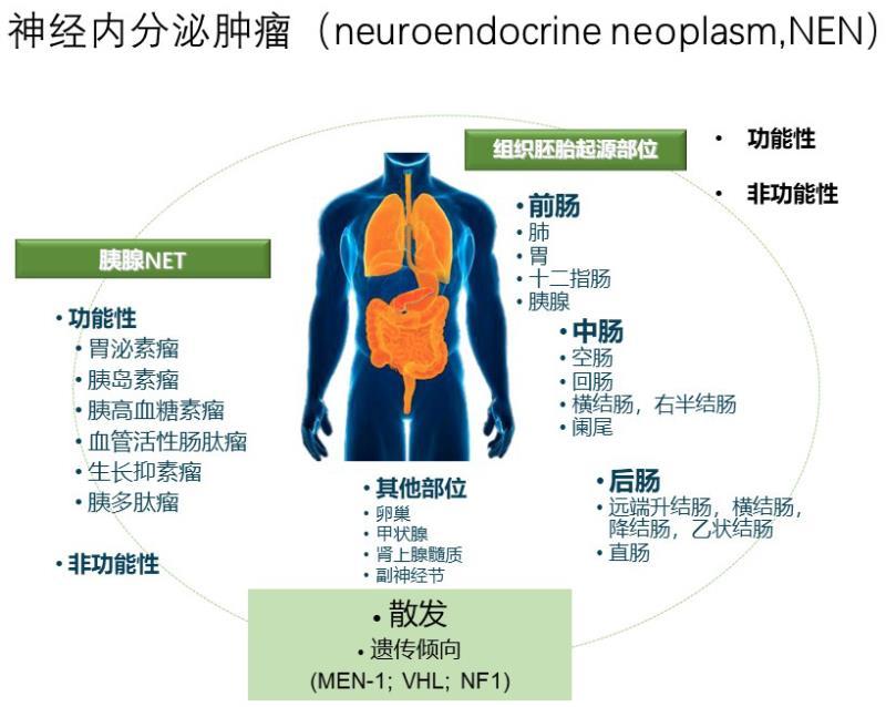 神经内分泌肿瘤到底是什么