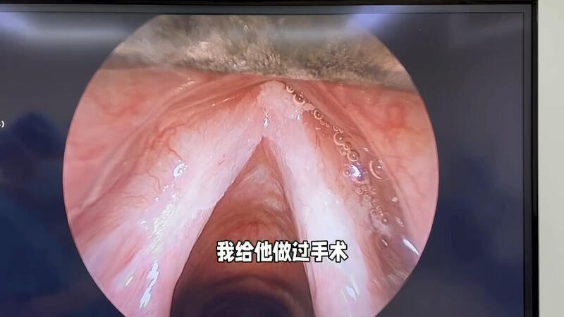 視頻封面