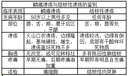口腔溃疡——鳞癌_鳞状细胞癌_鳞状细胞癌介绍 - 好大夫在线