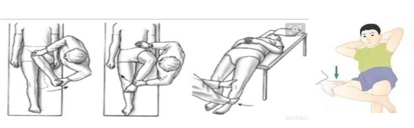 髋关节外展试验图图片