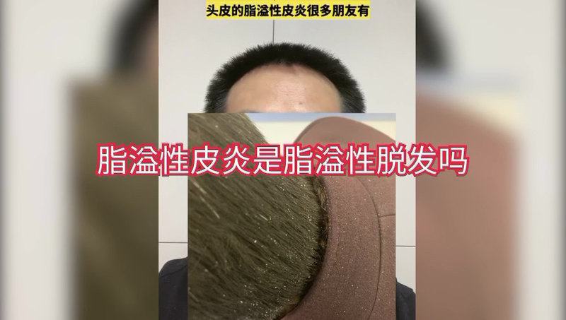 視頻封面