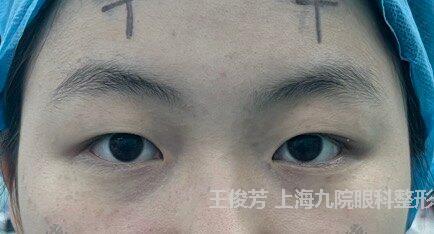 圖文圖片