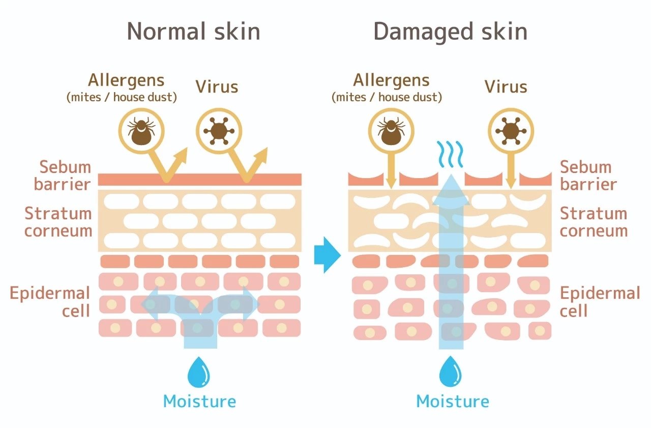 皮肤屏障在皮肤疾病治疗中的意义