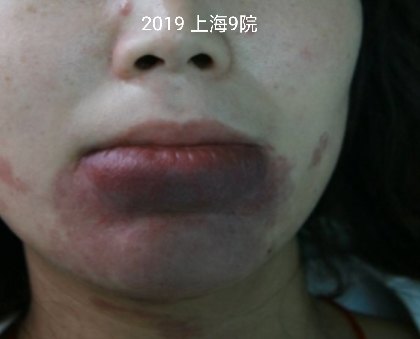 暂无