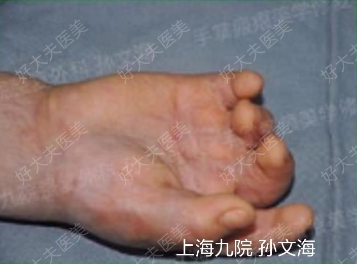 圖文圖片