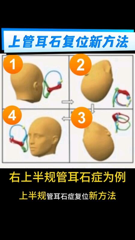 視頻封面
