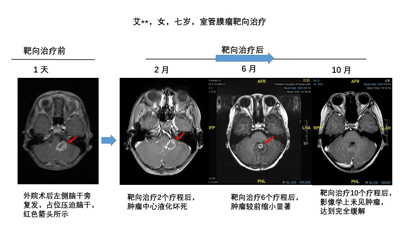 艾庆元靶向治疗.jpg