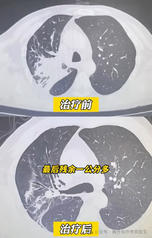 圖文圖片