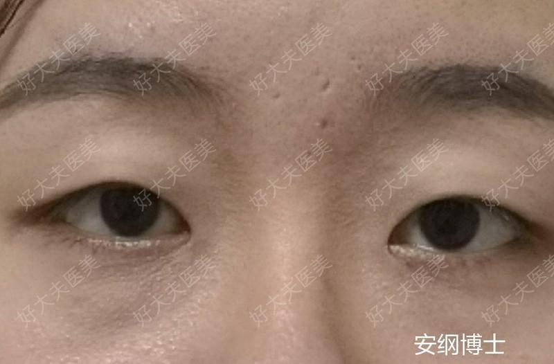 圖文圖片