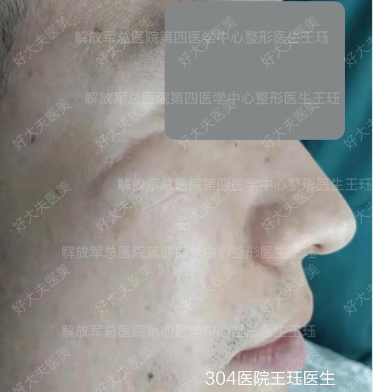 圖文圖片