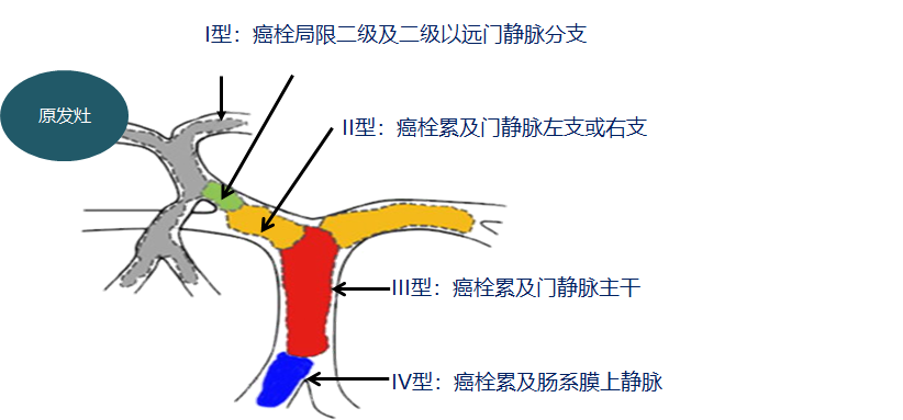 擅长：肿瘤介入治疗：肝癌的超分割放射治疗、经皮穿刺微波凝固治疗、射频治疗；食管癌外照射与近...黄牛代挂号的简单介绍