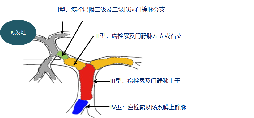 擅长:肿瘤介入治疗:肝癌的超分割放射治疗、经皮穿刺微波凝固治疗、射频治疗;食管癌外照射与近...黄牛代挂号的简单介绍 擅长:肿瘤介入治疗:肝癌的超分割放射治疗、经皮穿刺微波凝固治疗、射频治疗;食管癌外照射与近...黄牛代挂号的简单介绍