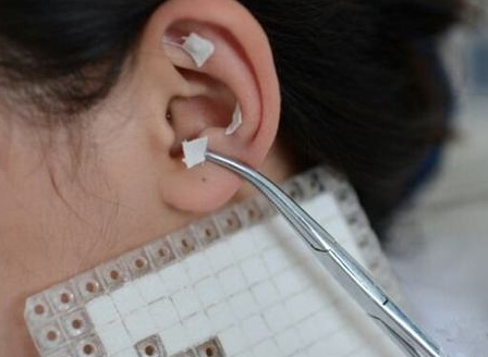 耳穴压豆法治疗耳鸣_耳鸣_耳鸣治疗方式 - 好大夫在线